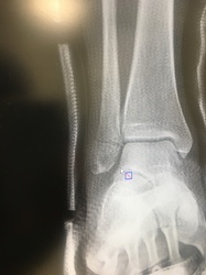 2020-03-10 17.39.34.jpg